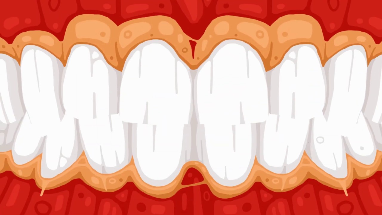 Call of Fries. New trailer for Steam.